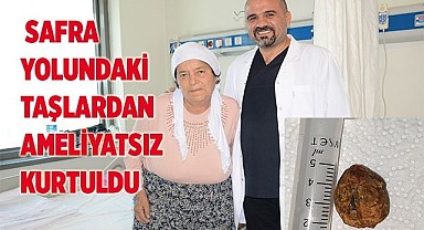 74 yaşındaki hasta safra yolundaki taşlardan ameliyatsız kurtuldu
