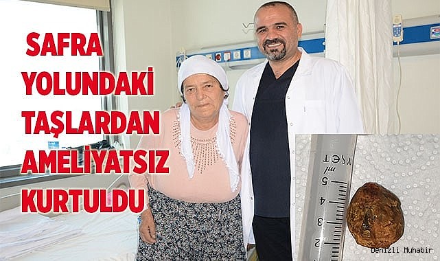 74 yaşındaki hasta safra yolundaki taşlardan ameliyatsız kurtuldu