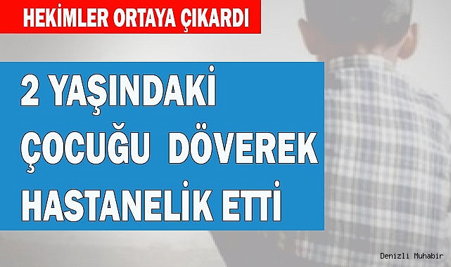 2 YAŞINDAKİ ÇOCUĞU DÖVEREK HASTANELİK ETTİ