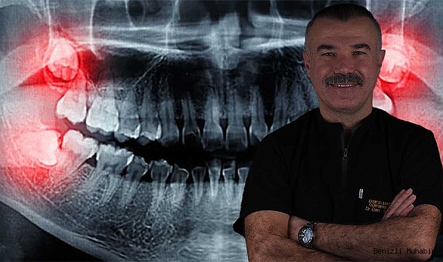 YİRMİLİK DİŞLER İHMALE GELMİYOR