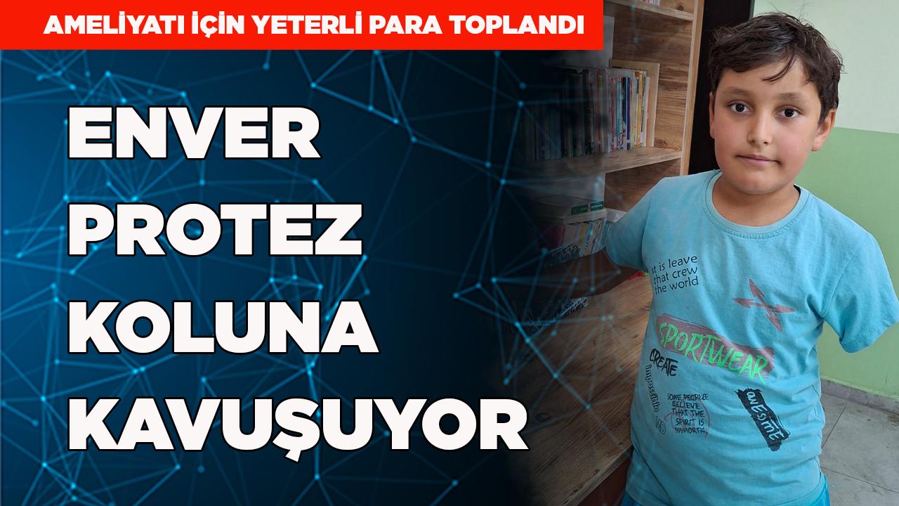 Denizli'de Enver protez koluna kavuşuyor