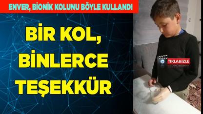 Enver İlhan biyonik kolunu ilk kez kullandı